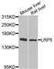 LDL Receptor Related Protein 5 antibody, A0130, ABclonal Technology, Western Blot image 