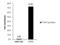 Protein C-ets-2 antibody, GTX104527, GeneTex, Chromatin Immunoprecipitation image 