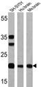 Presenilin 1 antibody, MA1-751, Invitrogen Antibodies, Western Blot image 