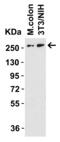 DnaJ homolog subfamily C member 13 antibody, 8109, ProSci Inc, Western Blot image 