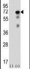 Ubiquitin Specific Peptidase 2 antibody, PA5-11992, Invitrogen Antibodies, Western Blot image 