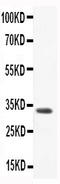 C-C Motif Chemokine Ligand 3 antibody, LS-C313417, Lifespan Biosciences, Western Blot image 