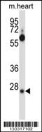 Serine/arginine-rich splicing factor 8 antibody, 57-064, ProSci, Western Blot image 