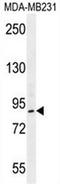 Lysine Acetyltransferase 2B antibody, AP53188PU-N, Origene, Western Blot image 