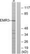 Adhesion G Protein-Coupled Receptor E3 antibody, abx015238, Abbexa, Western Blot image 
