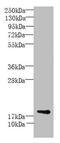 MORN Repeat Containing 5 antibody, CSB-PA736208LA01HU, Cusabio, Western Blot image 
