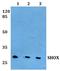 Short stature homeobox protein antibody, GTX66754, GeneTex, Western Blot image 