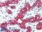 Peroxisomal Biogenesis Factor 7 antibody, LS-B8579, Lifespan Biosciences, Immunohistochemistry paraffin image 