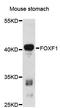 Forkhead Box F1 antibody, LS-C748079, Lifespan Biosciences, Western Blot image 