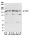 Glutamyl-Prolyl-TRNA Synthetase antibody, A303-959A, Bethyl Labs, Western Blot image 