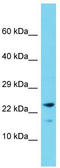 Cornichon Family AMPA Receptor Auxiliary Protein 2 antibody, TA331545, Origene, Western Blot image 