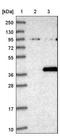 Zinc Finger Protein 177 antibody, NBP1-86523, Novus Biologicals, Western Blot image 
