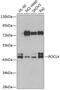 POC1 centriolar protein homolog A antibody, 22-961, ProSci, Western Blot image 