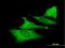 Protein unc-45 homolog A antibody, H00055898-B01P, Novus Biologicals, Immunofluorescence image 