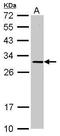 Solute Carrier Family 25 Member 15 antibody, GTX109432, GeneTex, Western Blot image 