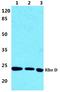 Rho-related GTP-binding protein RhoD antibody, A05942, Boster Biological Technology, Western Blot image 