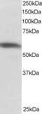 hnRNP I antibody, ab5642, Abcam, Western Blot image 