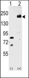 Low-density lipoprotein receptor-related protein 6 antibody, TA302210, Origene, Western Blot image 