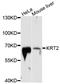 Keratin 2 antibody, A10375, ABclonal Technology, Western Blot image 