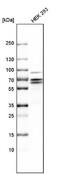 Cyclin Dependent Kinase 16 antibody, NBP1-92248, Novus Biologicals, Western Blot image 