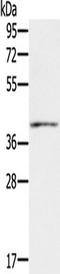 Interferon Gamma Receptor 2 antibody, TA351278, Origene, Western Blot image 