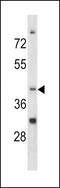 Nocturnin antibody, MBS9208081, MyBioSource, Western Blot image 