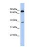 Proline Rich 19 antibody, NBP1-70686, Novus Biologicals, Western Blot image 