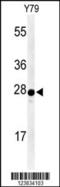 Serotonin N-acetyltransferase antibody, 64-035, ProSci, Western Blot image 