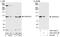 Ubiquitin Specific Peptidase 5 antibody, A301-542A, Bethyl Labs, Immunoprecipitation image 