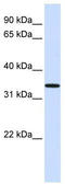 Chromosome 16 Open Reading Frame 78 antibody, TA340337, Origene, Western Blot image 