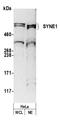 Spectrin Repeat Containing Nuclear Envelope Protein 1 antibody, A305-058A, Bethyl Labs, Western Blot image 