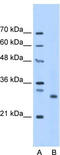 Homologous-pairing protein 2 homolog antibody, TA342445, Origene, Western Blot image 