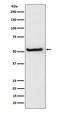 Thioredoxin Interacting Protein antibody, M01409, Boster Biological Technology, Western Blot image 