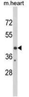 Early Growth Response 3 antibody, GTX81724, GeneTex, Western Blot image 