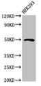 Motor neuron and pancreas homeobox protein 1 antibody, orb401524, Biorbyt, Western Blot image 