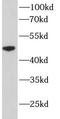 Cytochrome P450 Family 2 Subfamily D Member 6 antibody, FNab02157, FineTest, Western Blot image 