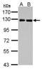Presequence protease, mitochondrial antibody, GTX121279, GeneTex, Western Blot image 