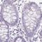 Synemin antibody, PA5-60647, Invitrogen Antibodies, Immunohistochemistry frozen image 