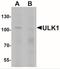 Unc-51 Like Autophagy Activating Kinase 1 antibody, NBP2-41217, Novus Biologicals, Western Blot image 