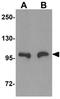 Zinc transporter ZIP10 antibody, GTX31994, GeneTex, Western Blot image 