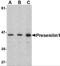 Presenilin 1 antibody, 4203, ProSci, Western Blot image 