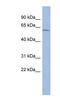Zinc Finger Protein 502 antibody, NBP1-80130, Novus Biologicals, Western Blot image 