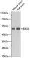 Dopamine Receptor D3 antibody, 15-637, ProSci, Western Blot image 