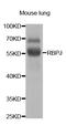 Recombination Signal Binding Protein For Immunoglobulin Kappa J Region antibody, TA332834, Origene, Western Blot image 
