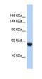 Adenosine Deaminase RNA Specific B2 (Inactive) antibody, orb324910, Biorbyt, Western Blot image 