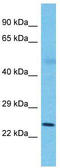 Solute Carrier Family 25 Member 26 antibody, TA333458, Origene, Western Blot image 