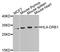 MHC II HLA-DR beta antibody, orb373689, Biorbyt, Western Blot image 