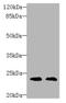 TIMP Metallopeptidase Inhibitor 3 antibody, A52050-100, Epigentek, Western Blot image 