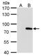 MX Dynamin Like GTPase 1 antibody, GTX629738, GeneTex, Western Blot image 