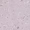 SLAM family member 8 antibody, HPA067601, Atlas Antibodies, Immunohistochemistry frozen image 